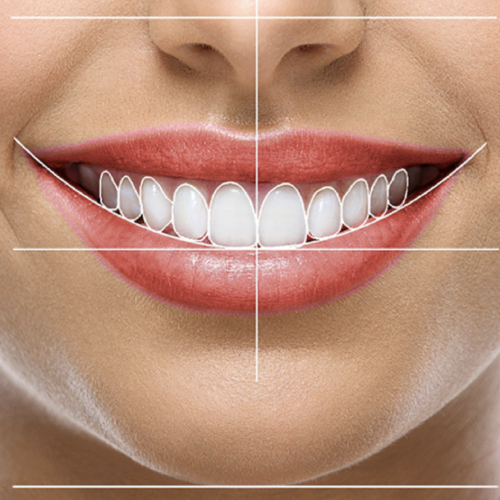 Esttica dental