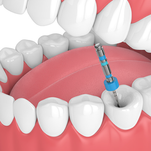 Imagen cirugía maxilofacial