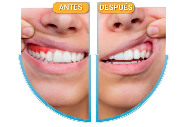Imagen cirugía maxilofacial