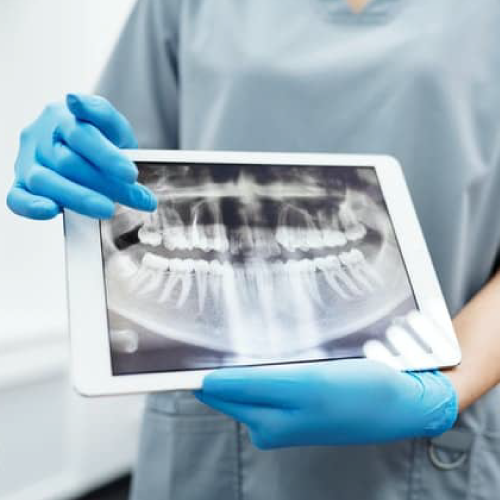 Imagen cirugía maxilofacial