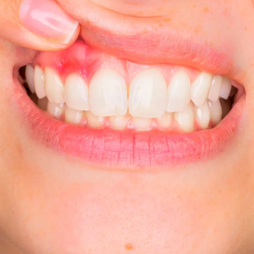 Imagen cirugía maxilofacial