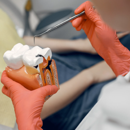 Imagen de Endodoncia