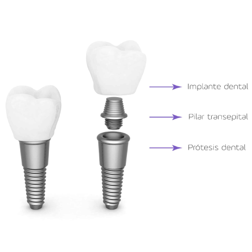 Imagen cirugía maxilofacial
