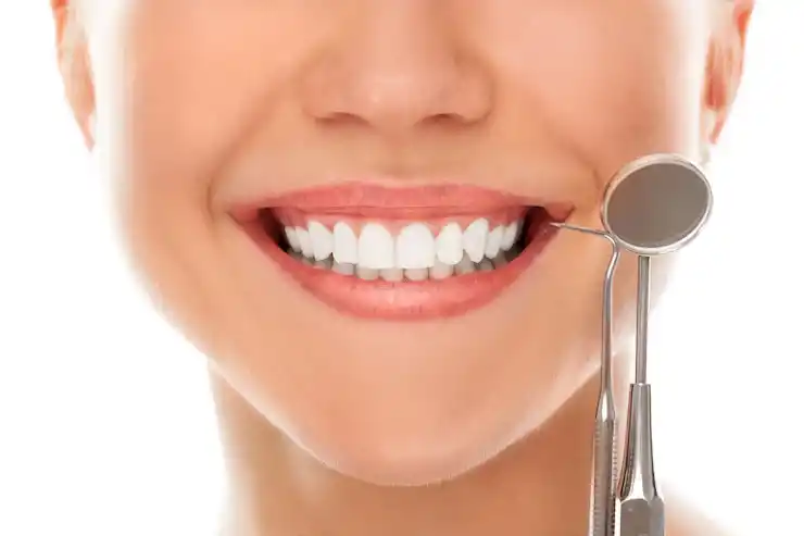Diseno de Sonrisa