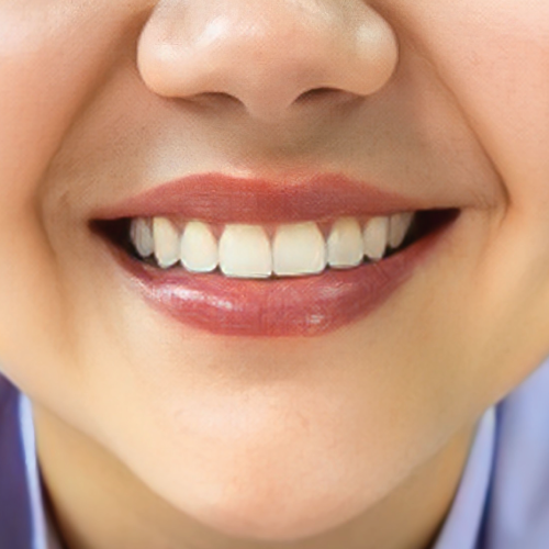 estetica dental