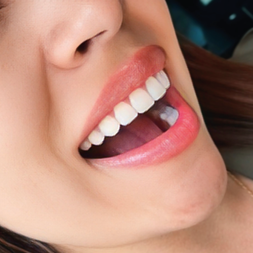 Imagen rehabilitacion oral