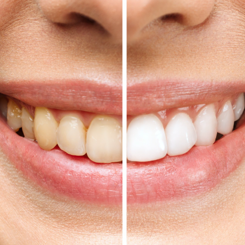 Imagen cirugía maxilofacial