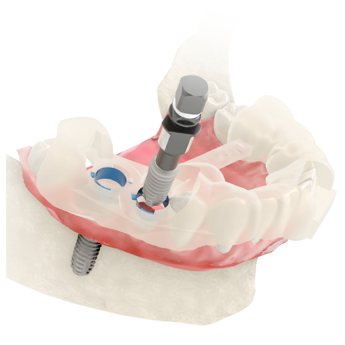 Imagen cirugía maxilofacial