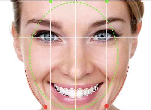 Diseno de Sonrisa