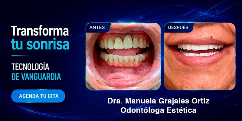 Diseno de Sonrisa